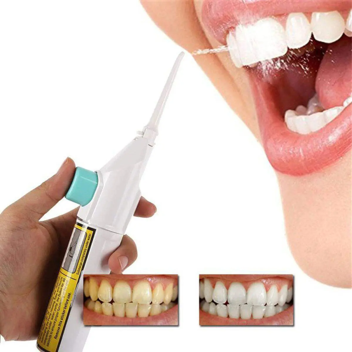 Portable Power Floss Dental Water Jet Cords Teeth Cleaner Kit